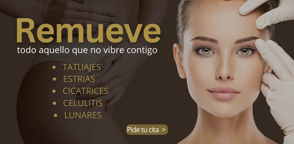 Procedimientos Remueve 